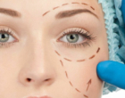 Cirurgias plásticas devolvem autoestima a quem sofreu paralisia facial